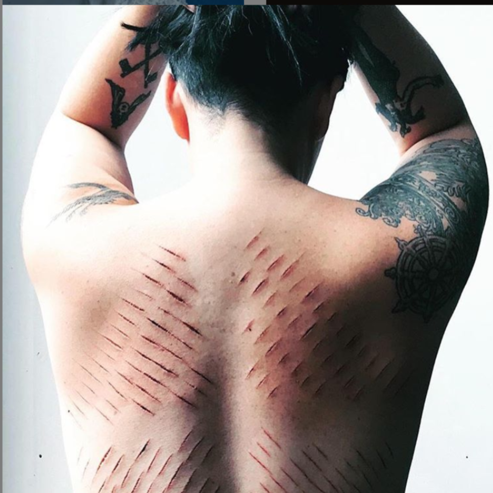Photo of a person's bare back, with multiple cuts and slashes. 