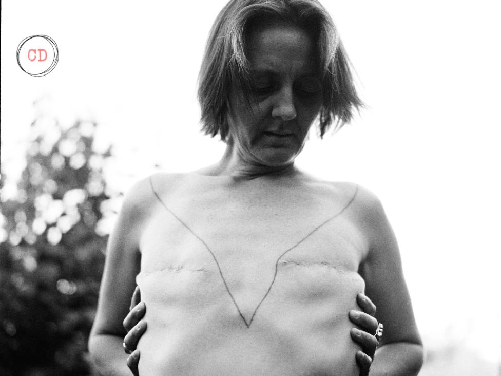 2 months post DMX. Jmy by Elizabeth Herring